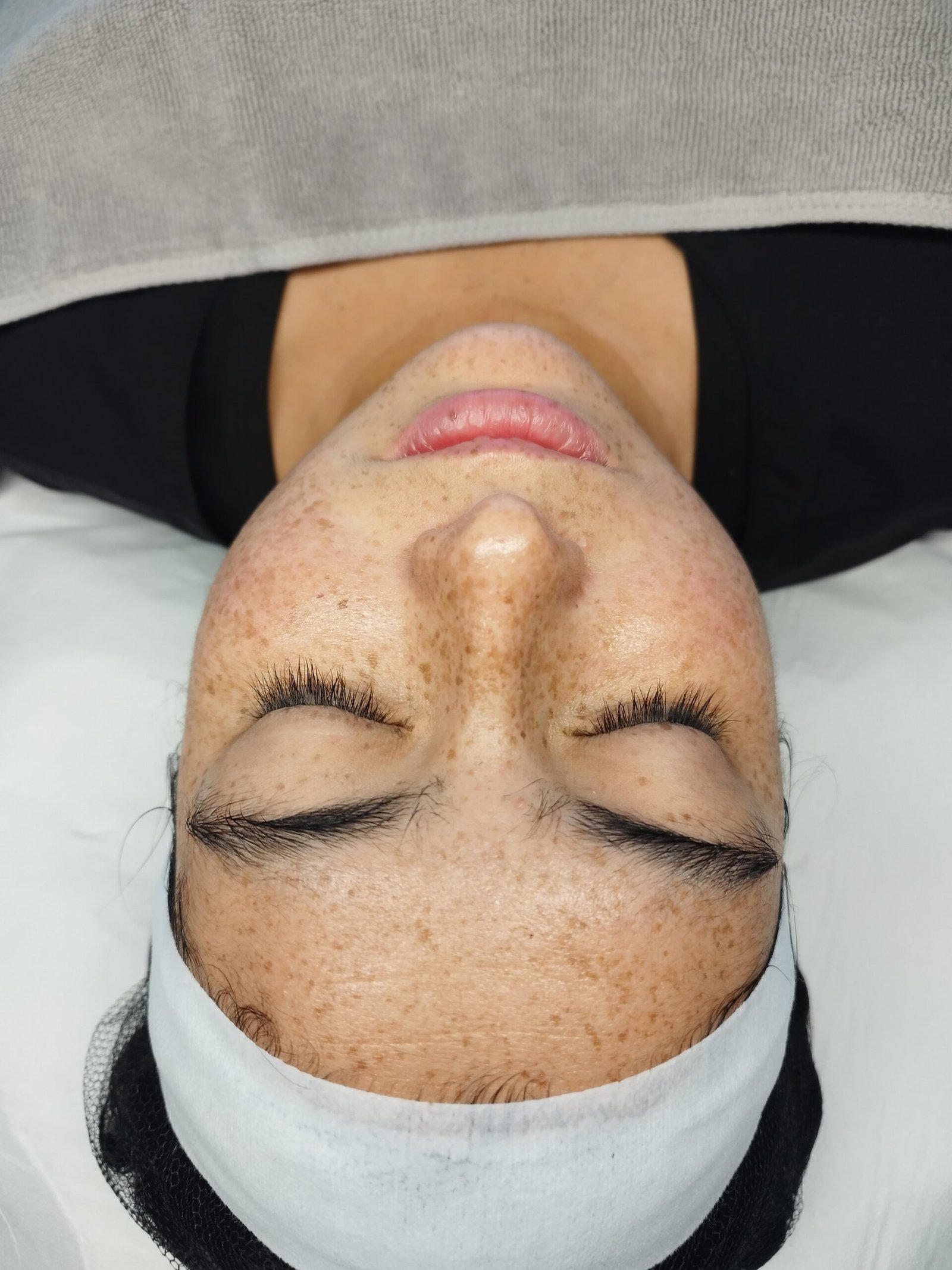 Paciente en libellskin