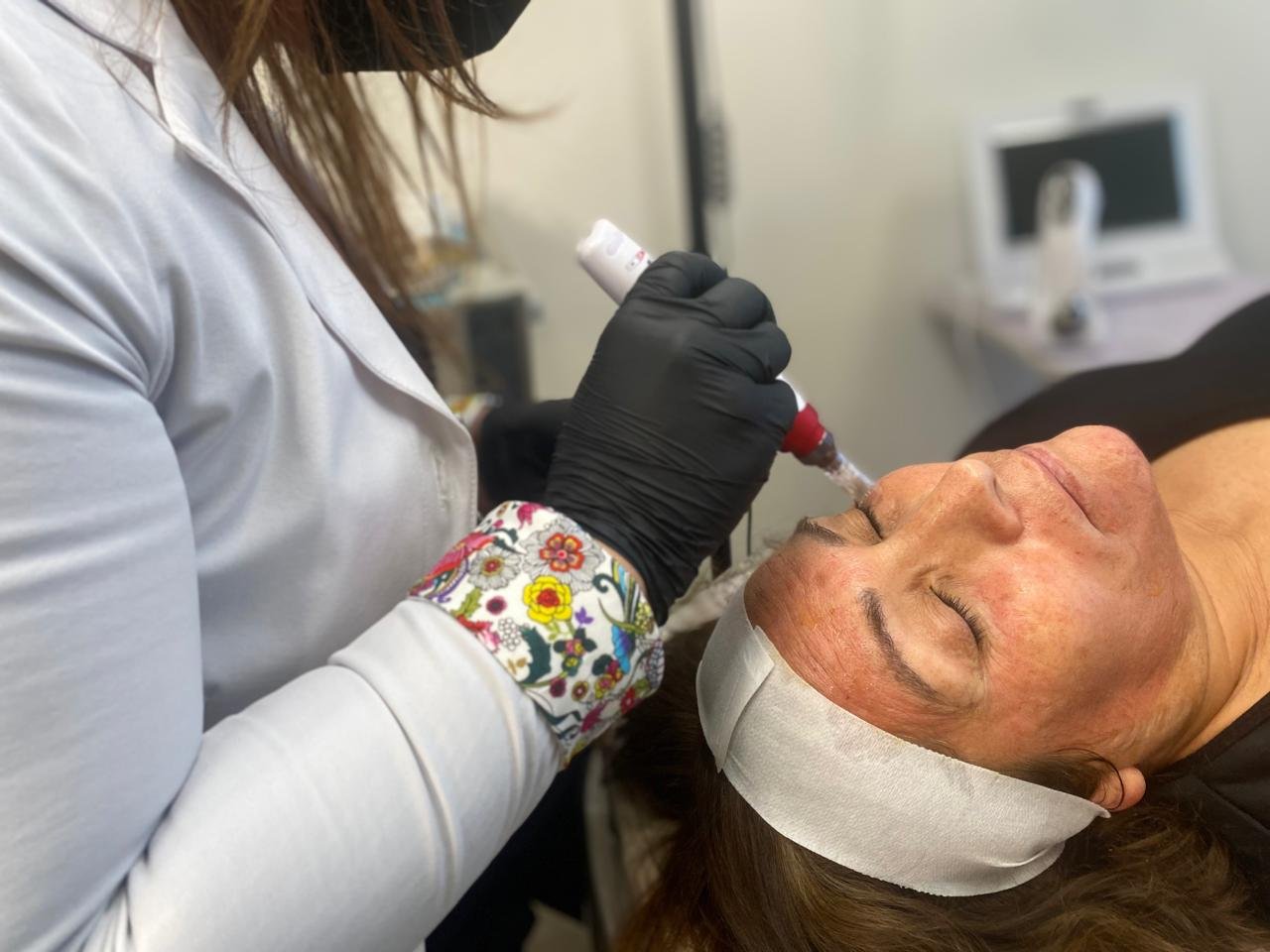 Mujer recibiendo tratamiento de exosomas