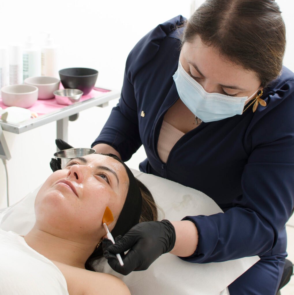 Tratamiento de peeling