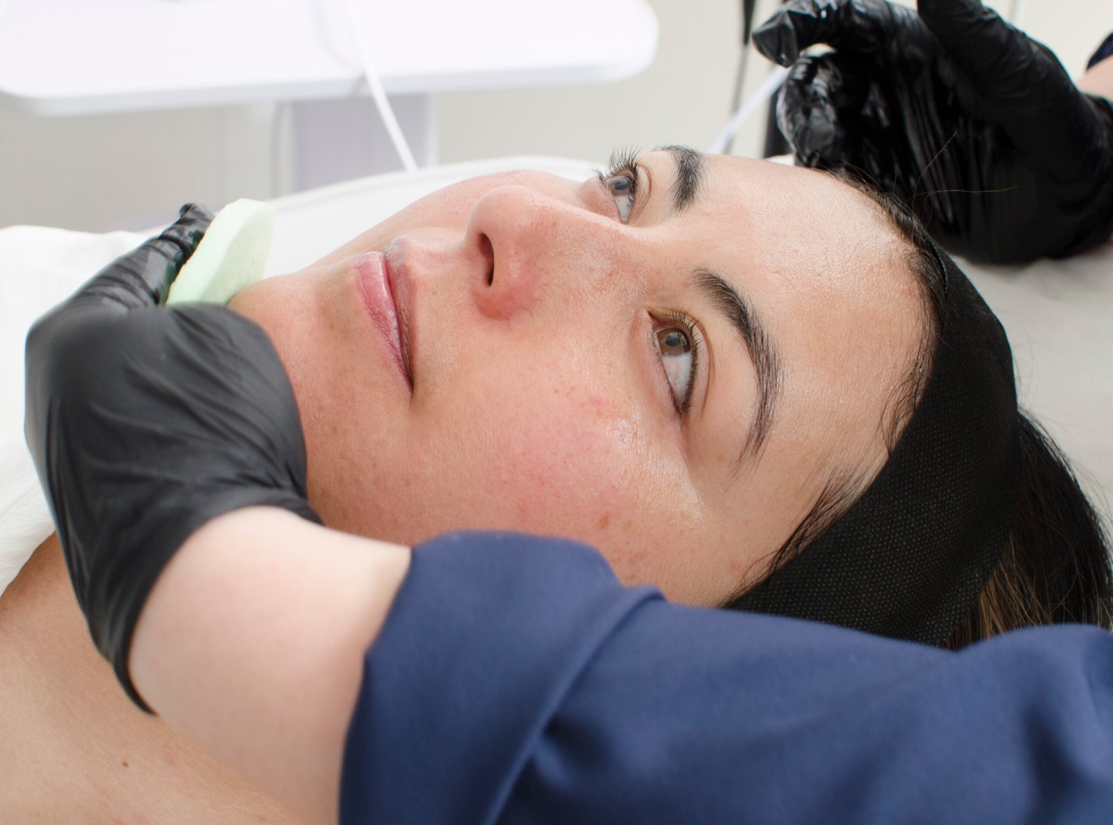 Imagen resultado PRP